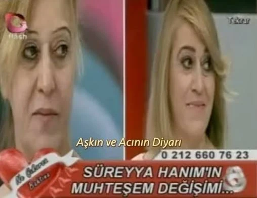 Media 1